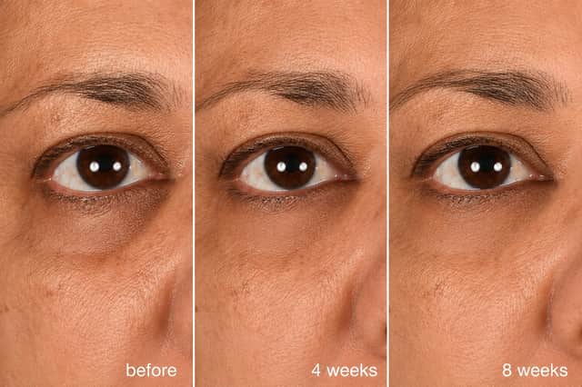 Dermalogica says its Smart Eye Density Serum can rebuild under-eye density by 129% after four weeks, with this clinical imagery showing results before use, at four weeks and at eight weeks.