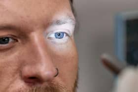The impact diabetes can have on your eyesight